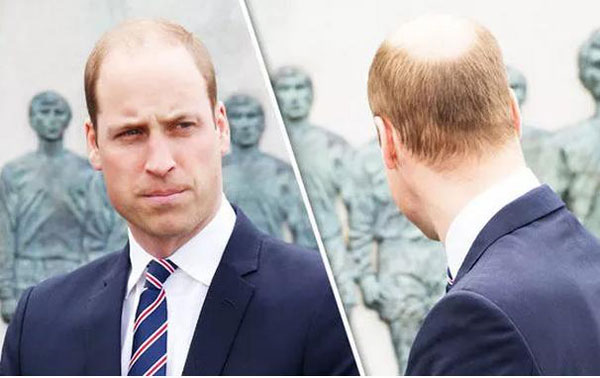 拿什么拯救90后的發(fā)際線？別急，科學(xué)家找到辦法啦