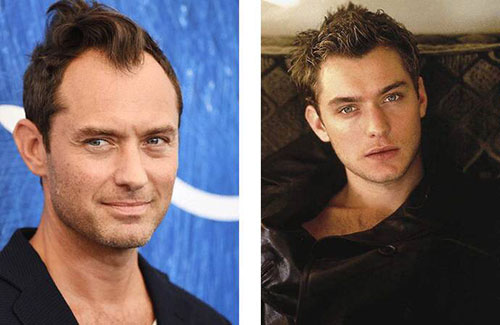 為什么男性禿頭都禿成一個樣？心疼男神們的發(fā)際線