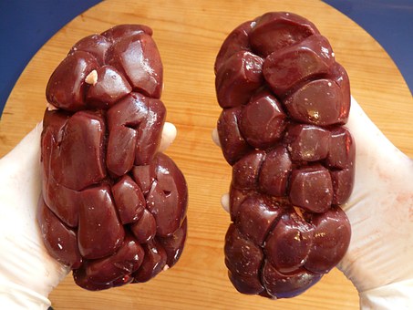 盡管腎臟供體短缺，美國還是丟棄了數(shù)千個(gè)腎臟