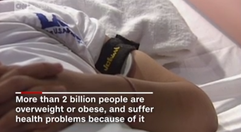 到2030年，全球肥胖兒童將超過2.5億